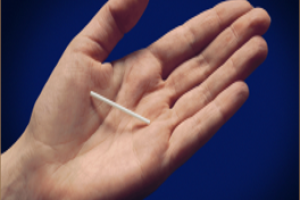 implant